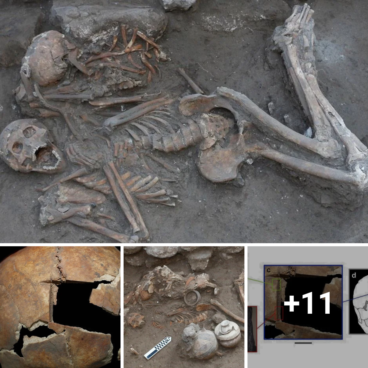 Archaeologists Discover Early Evidence of Cranial Surgery in the Near East, Revealing Ancient Advances