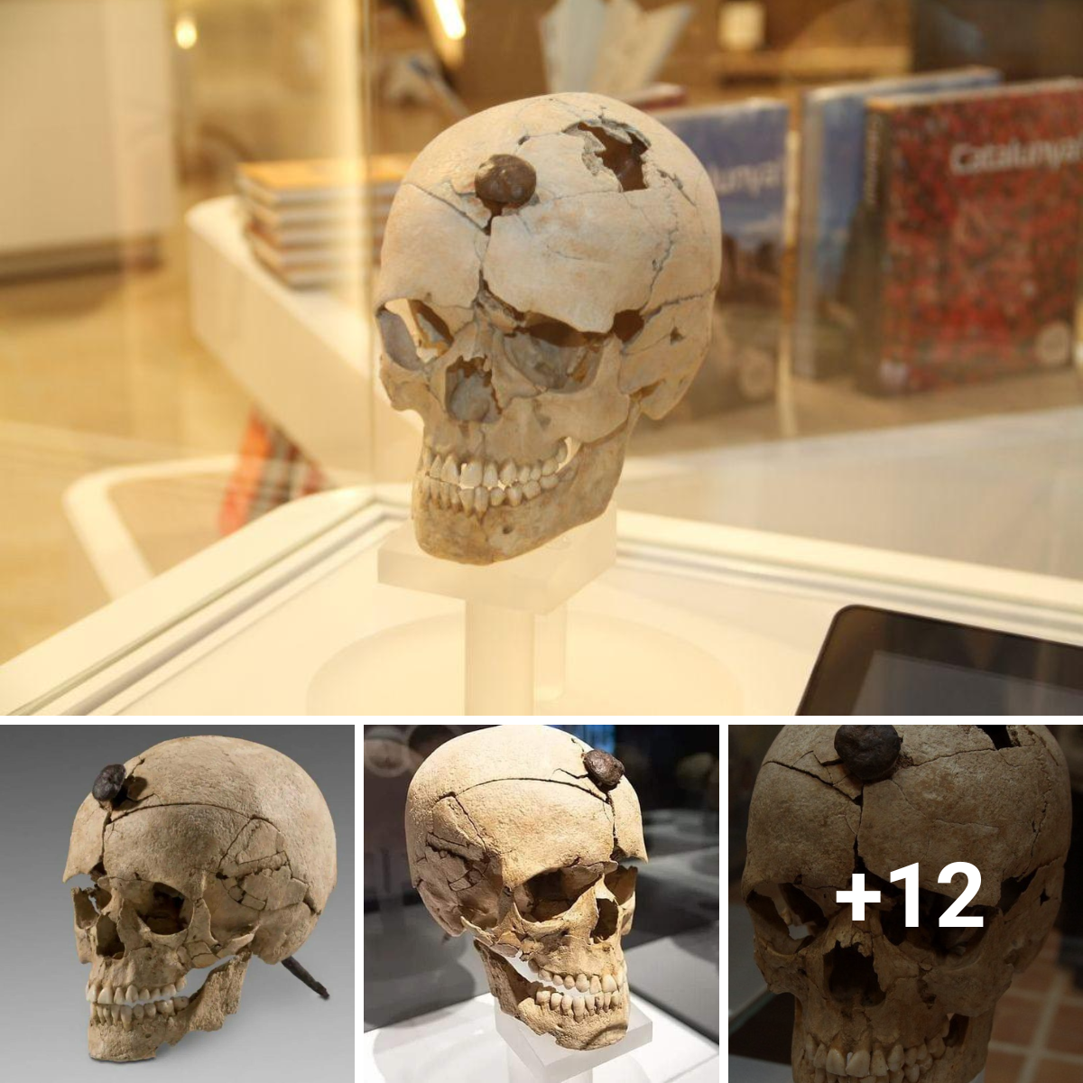Discover a historical mystery: The iron-nailed skull of an ancient young warrior