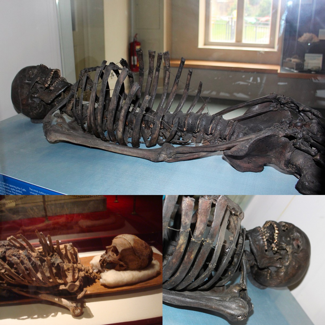 Desentrañando el Enigma: La ѕаɡа del Hombre de Gristhorpe, un Esqueleto de la Edad de Bronce. Hulk